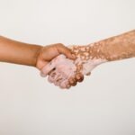 Unlocking Relief: Comprehensive Guide to Managing Plaque Psoriasis